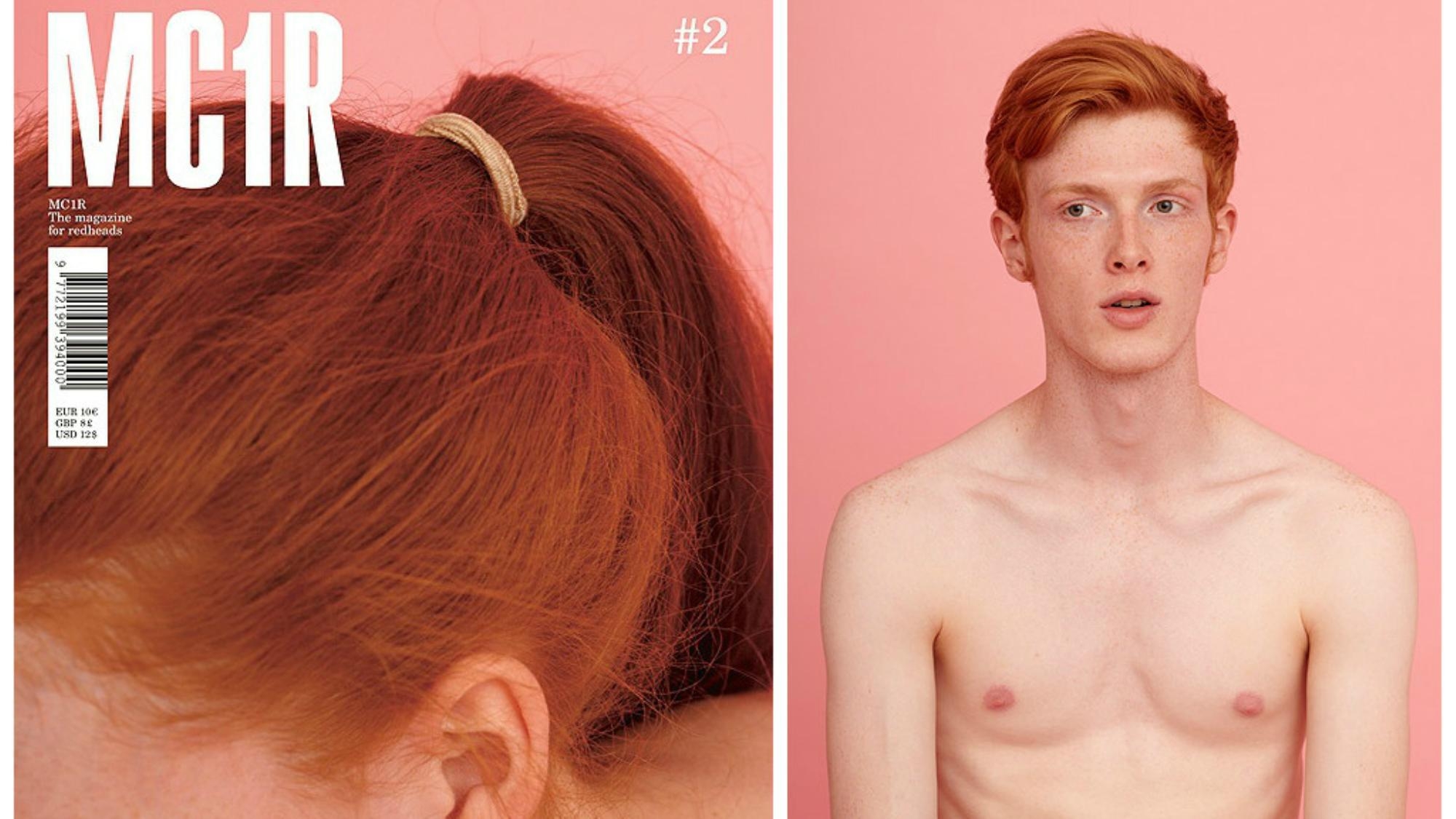 MC1R: das weltweit erste magazin von und über Rothaarige.